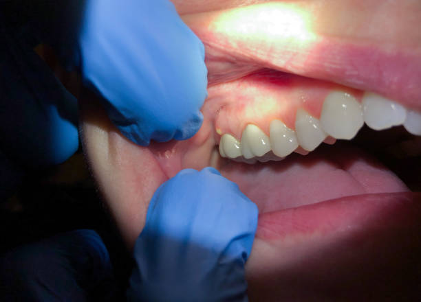 Best Same-Day Emergency Dentist in Berwyn, PA